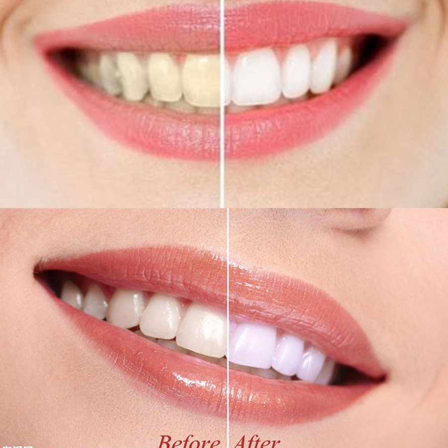 Bamboo Charcoal Teeth Tooth De - đánh giá và giá Teeth Paint Whitening