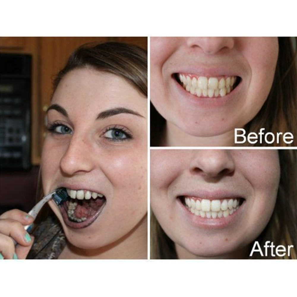 Bamboo Charcoal Teeth Tooth De - đánh giá và giá Teeth Paint Whitening