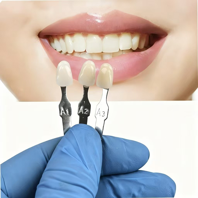 VITA 16 Colors Teeth Shade Gui - đánh giá và giá Teeth Whitening Express
