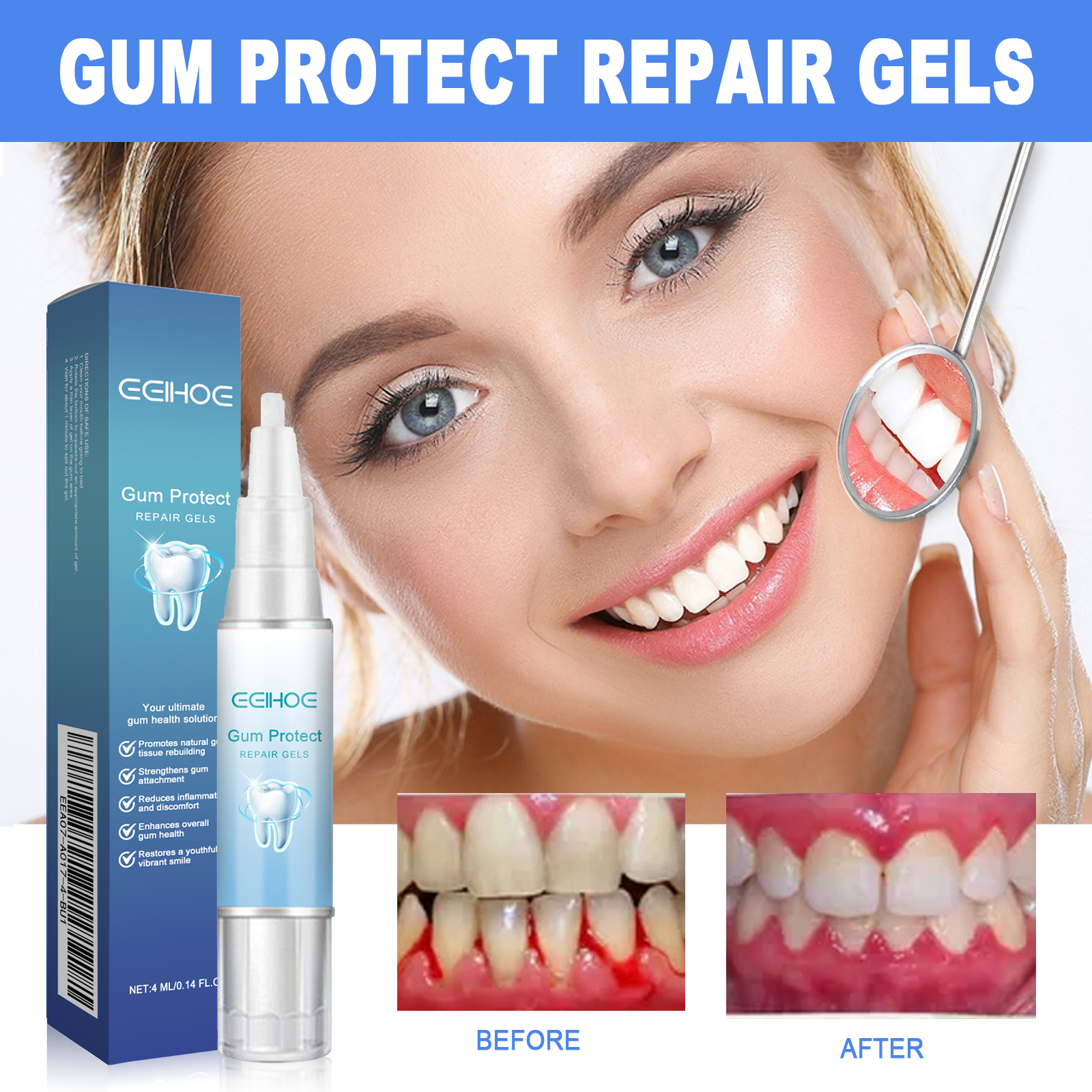 Damaged Gum Repair Care Gel De - đánh giá và giá Teeth Whitening With Peroxide