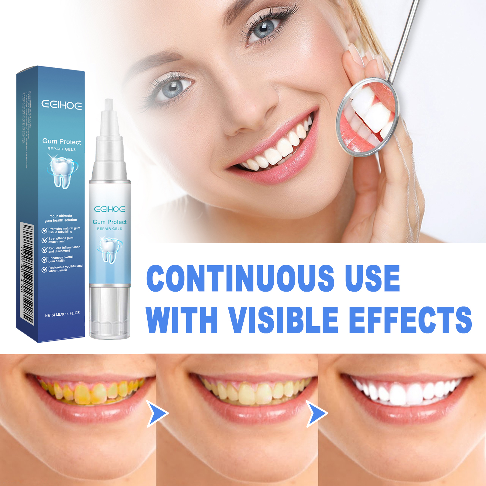 Damaged Gum Repair Care Gel De - đánh giá và giá Teeth Whitening With Peroxide