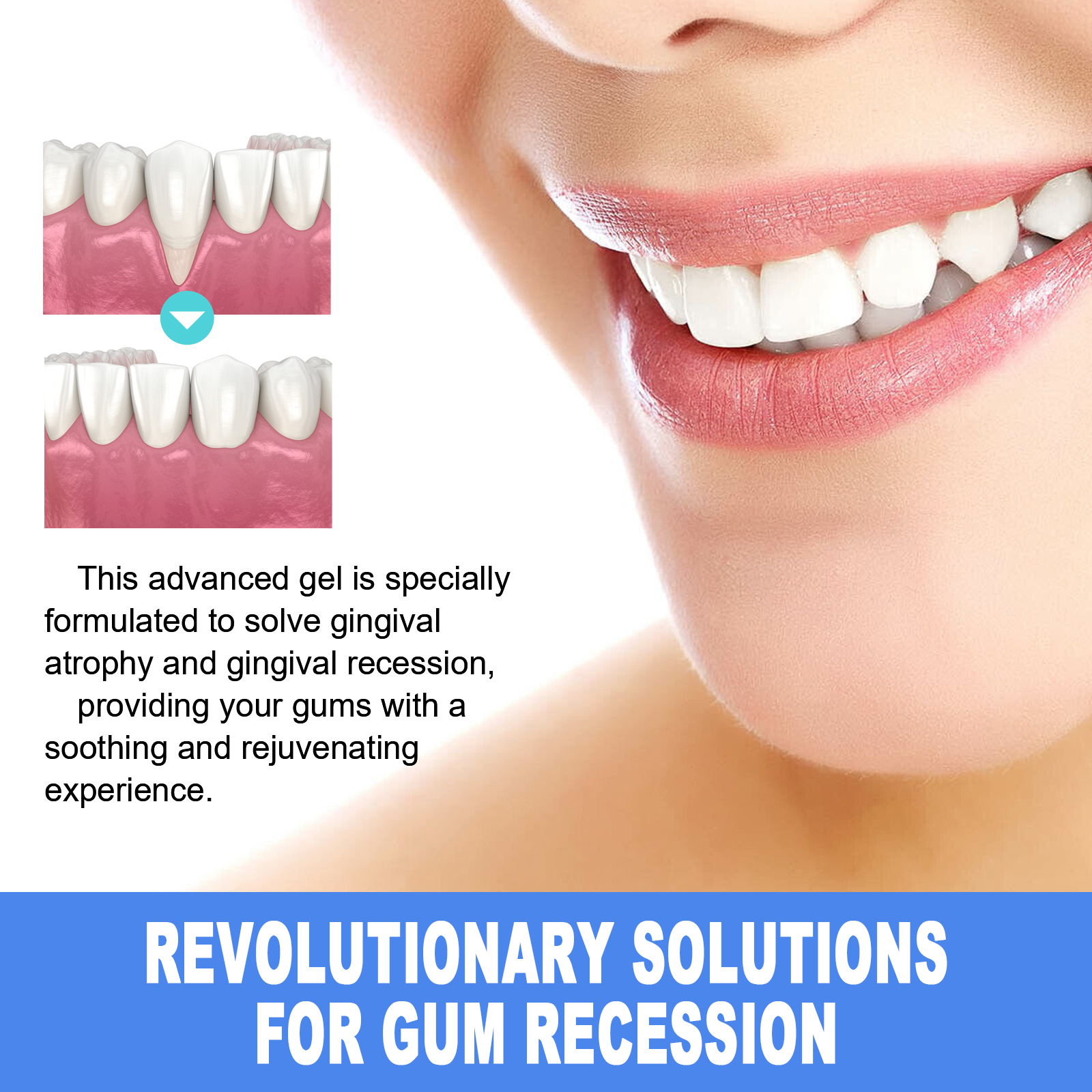 Damaged Gum Repair Care Gel De - đánh giá và giá Teeth Whitening With Peroxide