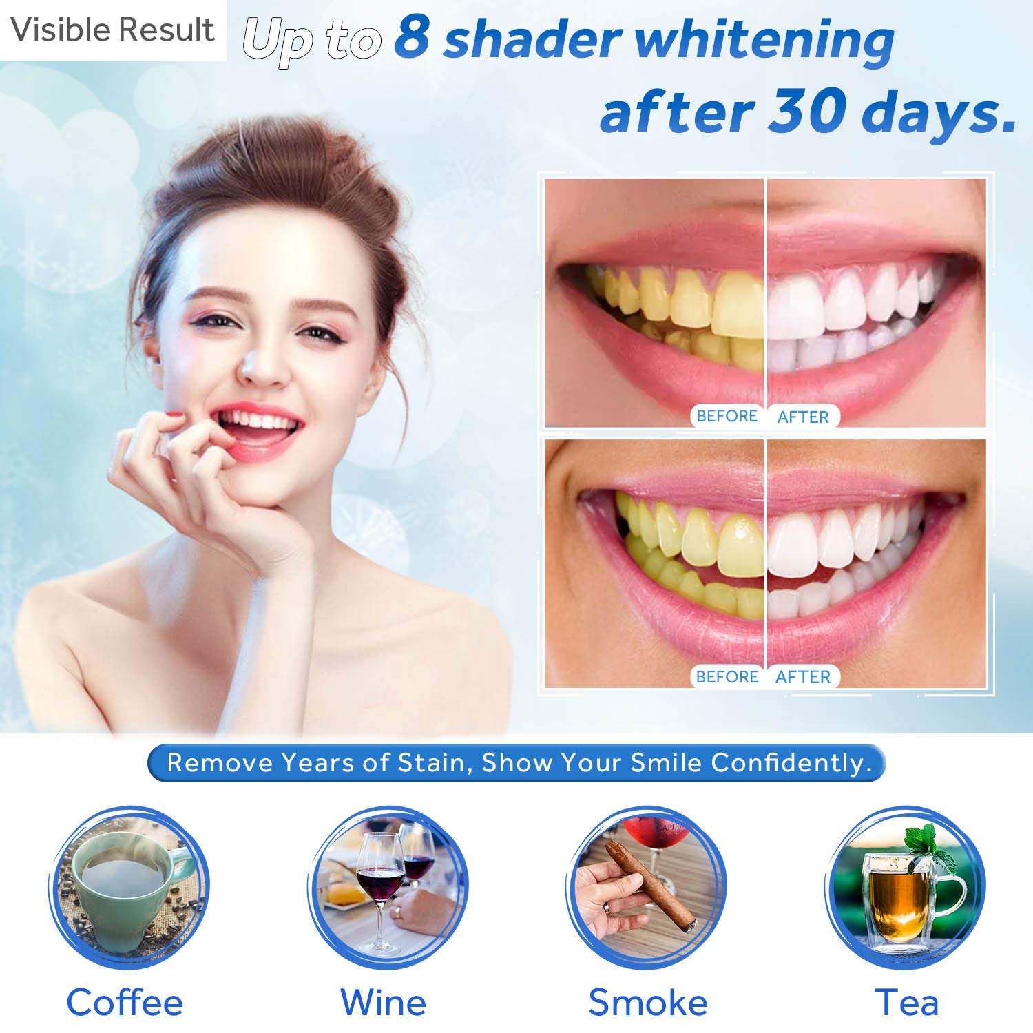 Teeth Whitening Gel Refill Syr - đánh giá và giá Teeth Whitening Kit At Home