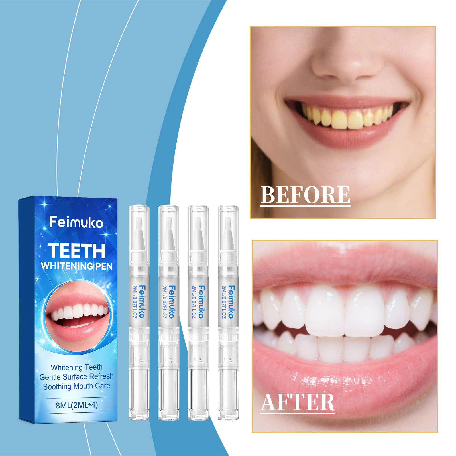 Feimuko 8ml Teeth Gel Pen Gent - đánh giá và giá Teeth Whitening With Peroxide