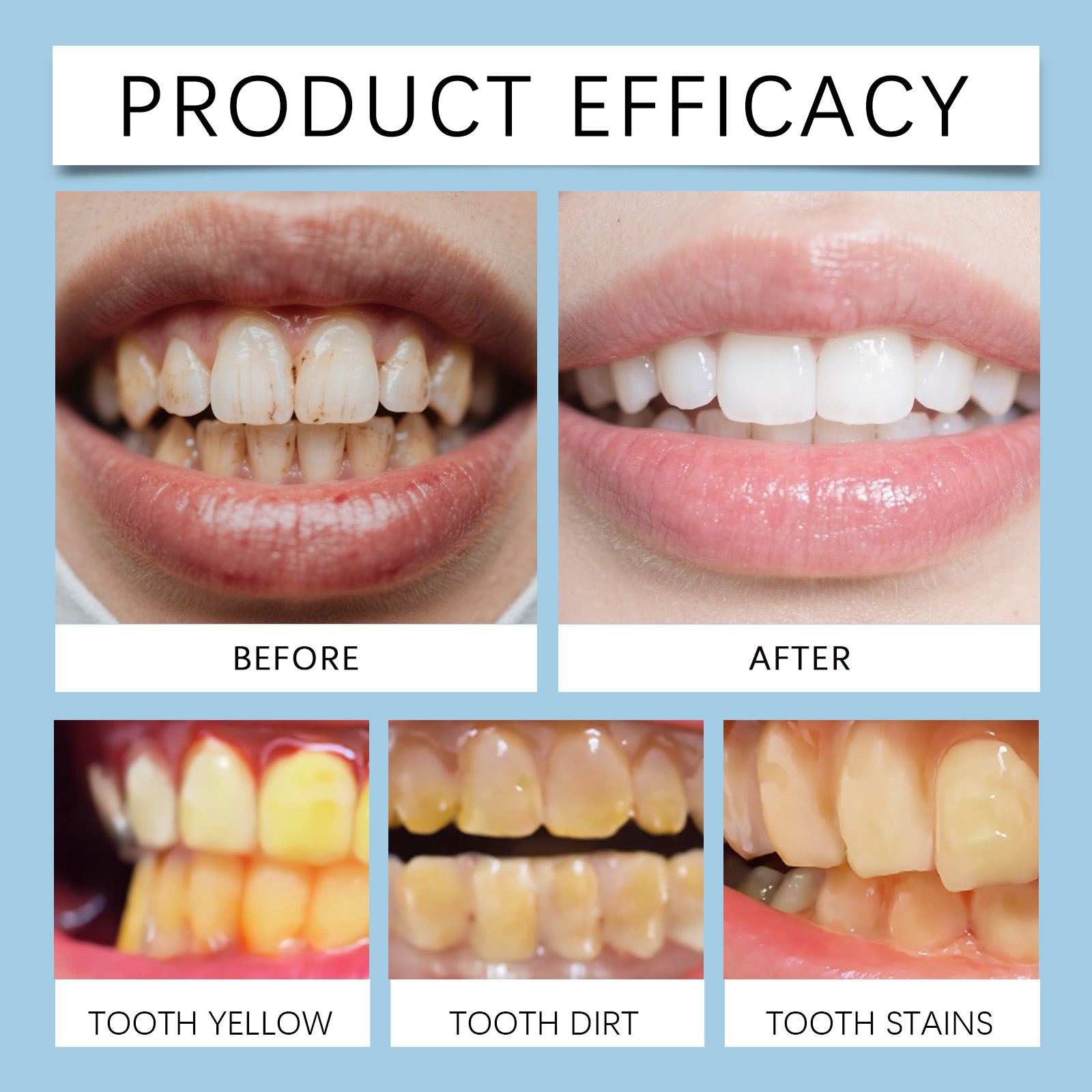 Feimuko 8ml Teeth Gel Pen Gent - đánh giá và giá Teeth Whitening With Peroxide