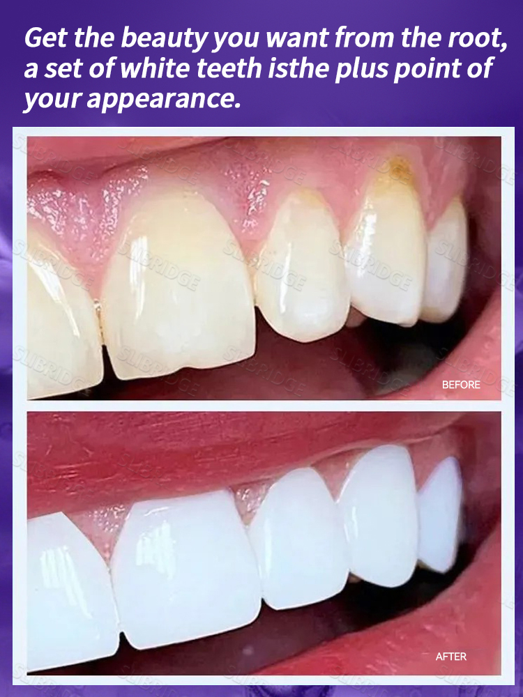 Winter holiday promotion: Purp - đánh giá và giá Teeth Whitening Promotion