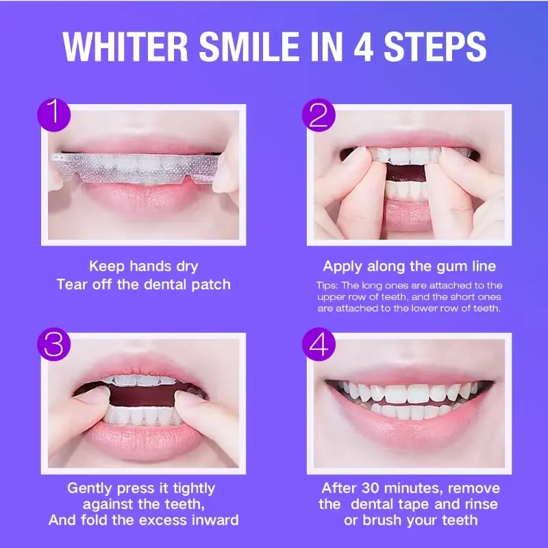 Teeth Whitening Kit - 5X LED L - đánh giá và giá Teeth Whitening Strips