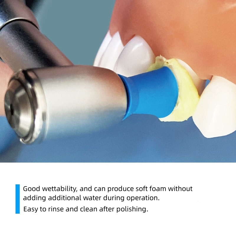 40g/Tube Dental Tooth Polishin - đánh giá và giá Teeth Whitening Express