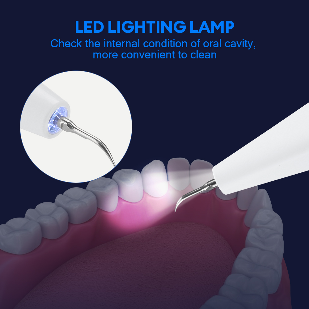 Ultrasonic Dental Calculus Rem - đánh giá và giá Teeth Whitening Strips