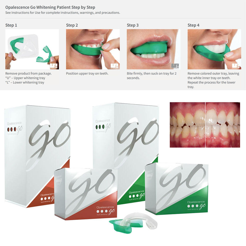Opalescence Go Teeth Whitening - đánh giá và giá Teeth Whitening Kit At Home