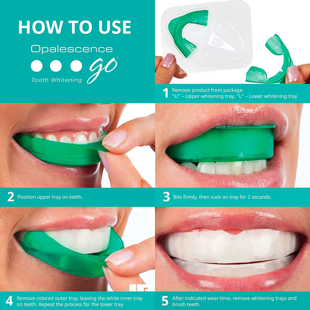 Opalescence Go Teeth Whitening - đánh giá và giá Teeth Whitening Kit At Home
