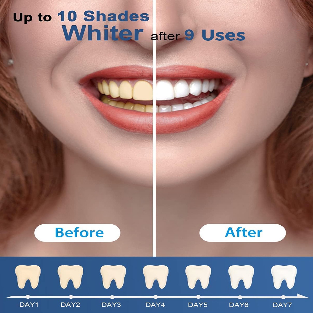 Teeth Whitening Kit - 5X LED L - đánh giá và giá Teeth Whitening Kit At Home