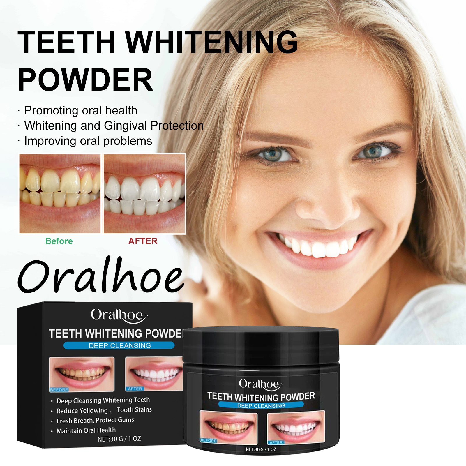 Oralhoe Charcoal Teeth Whiteni - đánh giá và giá Teeth Whitening Promotion
