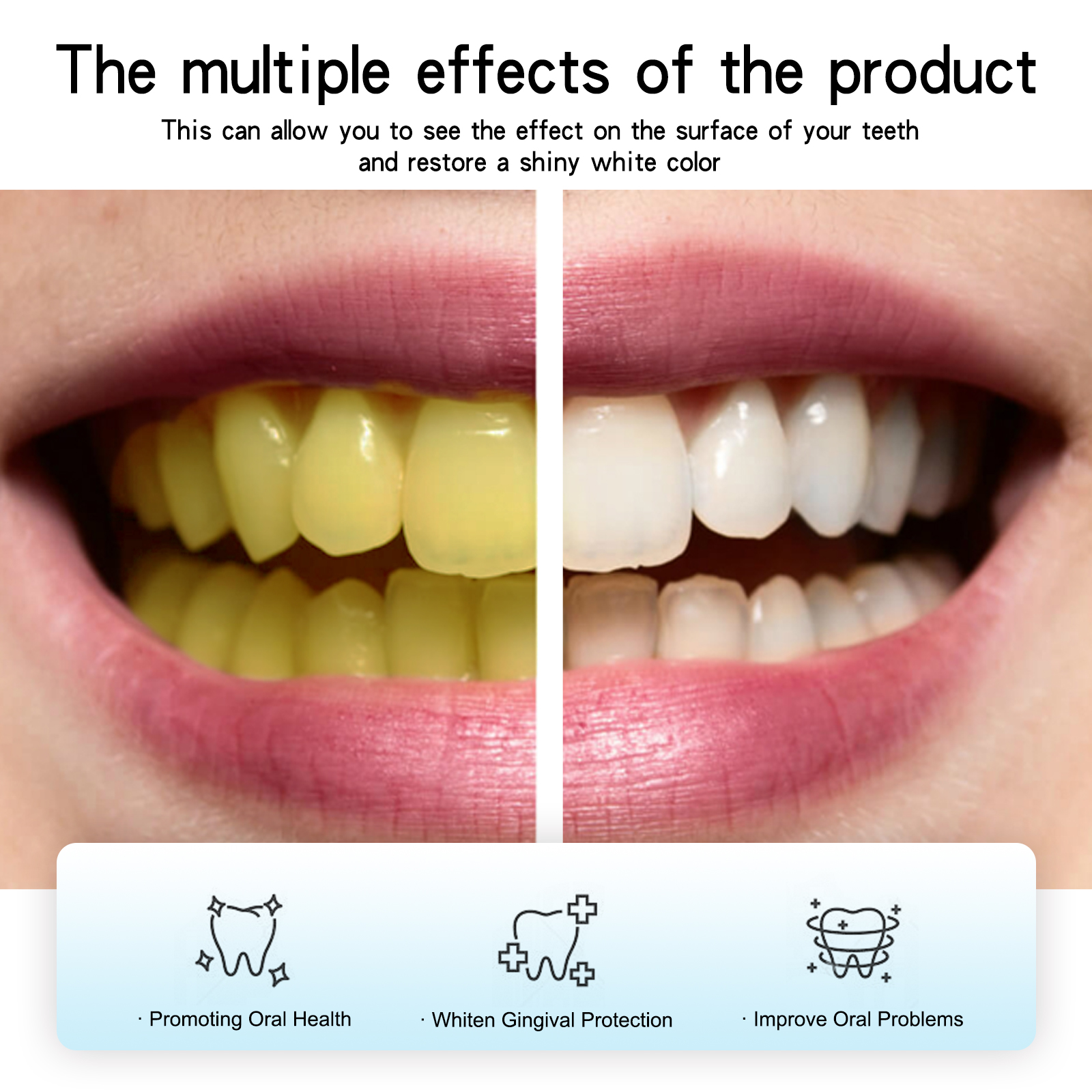 Oralhoe Charcoal Teeth Whiteni - đánh giá và giá Teeth Whitening Promotion
