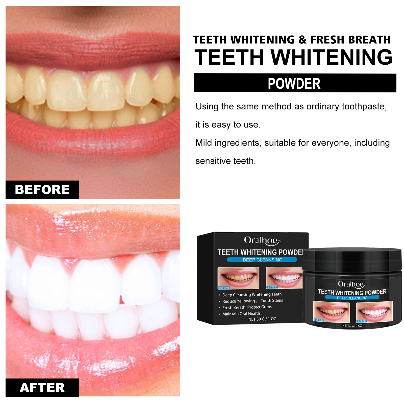Oralhoe Charcoal Teeth Whiteni - đánh giá và giá Teeth Whitening Promotion