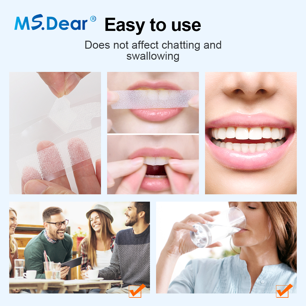 Teeth Whitening Strips Cleansi - đánh giá và giá Teeth Whitening With Peroxide